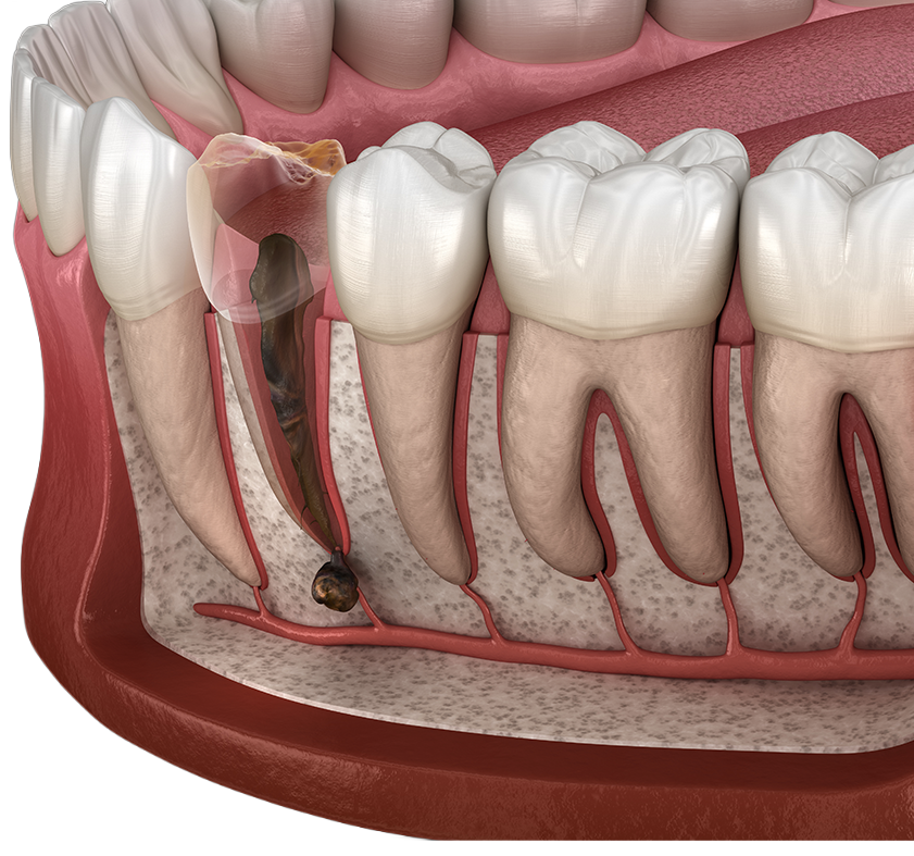 datalCare04_con01_01